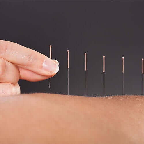 Acupuncturist Paid Ads Strategies