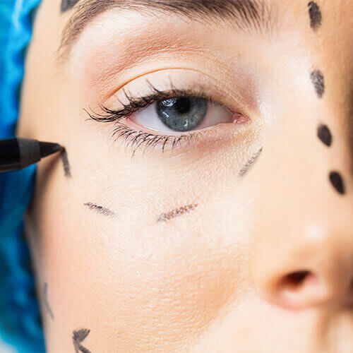 Plastic Surgeon Paid Ads Strategies